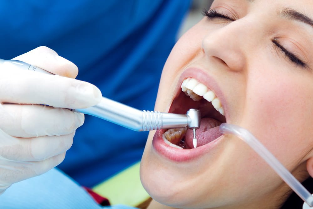 SDF Cavity treatment in moshi
